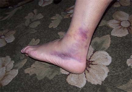 trail run fall